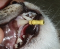 Эндодонтия. Лечение зубных каналов.