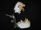 Модель челюстей в окклюдаторе с изготовленной коронкой.